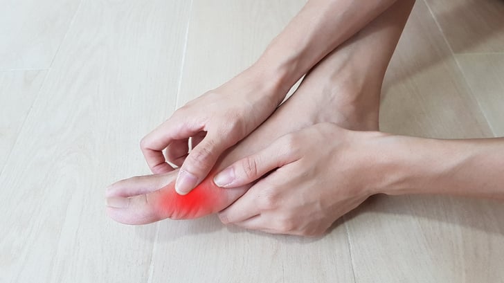 What is Gout and How Does it Affect Your Joints?